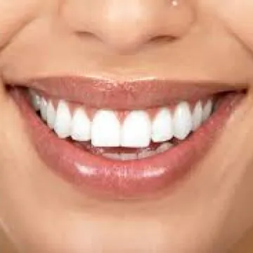 https://premiumdentalturkey.com//uploads/straight_teeth_1.jpeg