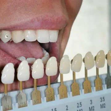 How to Choose Your Teeth Colour?