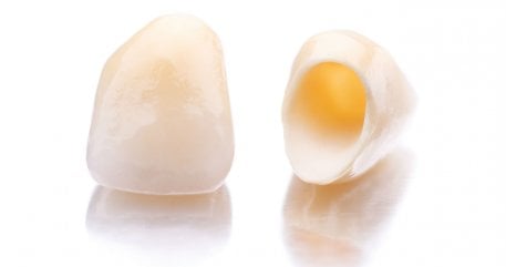 DENTAL CROWNS TURKEY DENTAL CROWNS TURKEY