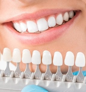 How to Choose Your Teeth Colour?