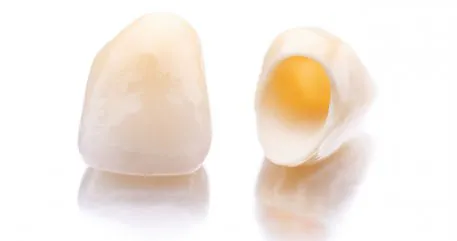 DENTAL CROWNS TURKEY