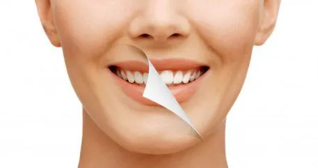 SMILE MAKEOVER TURKEY
