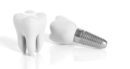 DENTAL IMPLANTS TURKEY