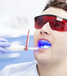 PROFESSIONAL TEETH WHITENING Turkey