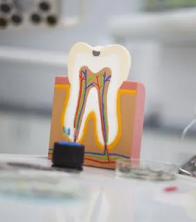 ROOT CANAL TREATMENT Turkey