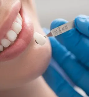 What is the Difference between Emax Crowns and Zirconium Crowns?