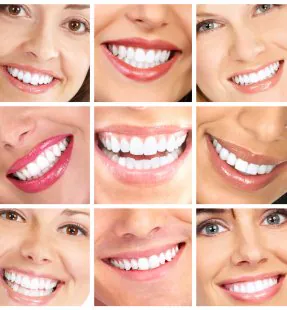 Dental Veneers Abroad