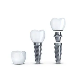 DENTAL IMPLANTS TURKEY Turkey