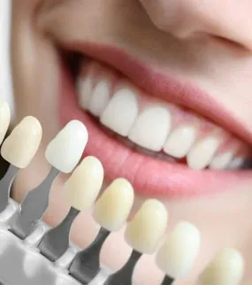SMILE MAKEOVER IN TURKEY Turkey