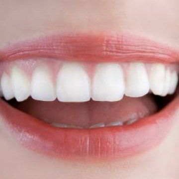 Teeth Grinding - Bruxism Treatment