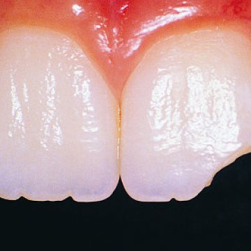 Affordable Solutions for Top 10 Dental Issues in Turkey