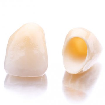 What is the Difference between Dental Crowns and Dental Veneers?