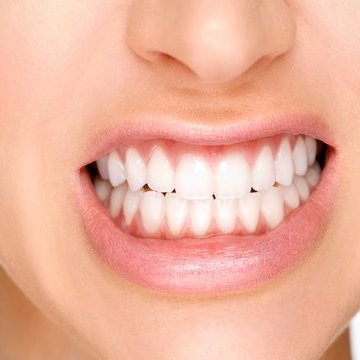 Teeth Grinding - Bruxism Treatment