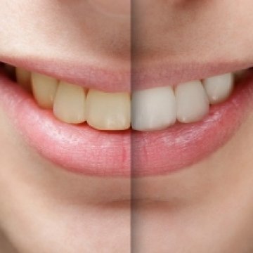 Affordable Solutions for Top 10 Dental Issues in Turkey