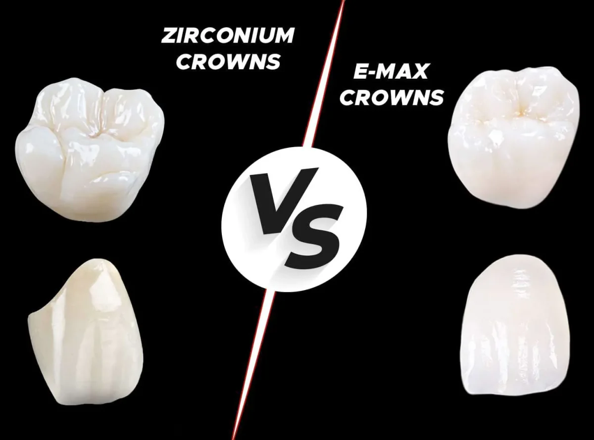 emax vs zirconia
