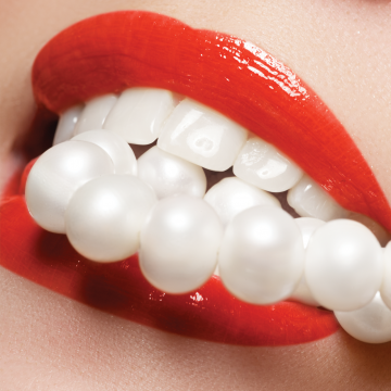 Hollywood Smile