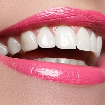 Hollywood Smile
