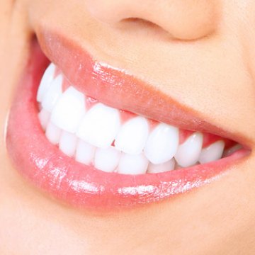 Hollywood Smile