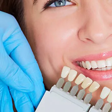 How to Choose Your Teeth Colour?