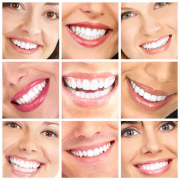 Dental Veneers Abroad