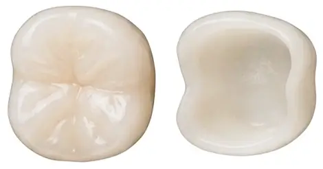 E-max crowns
