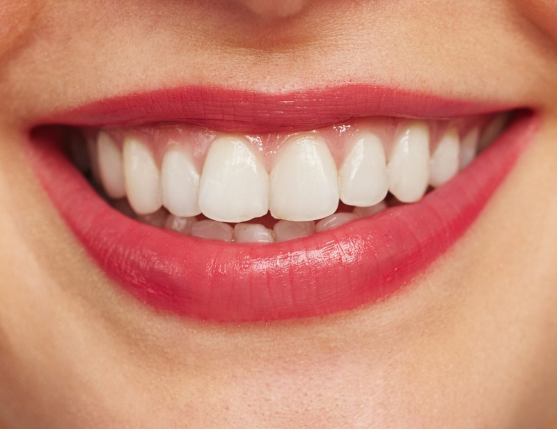 Zirconium crowns